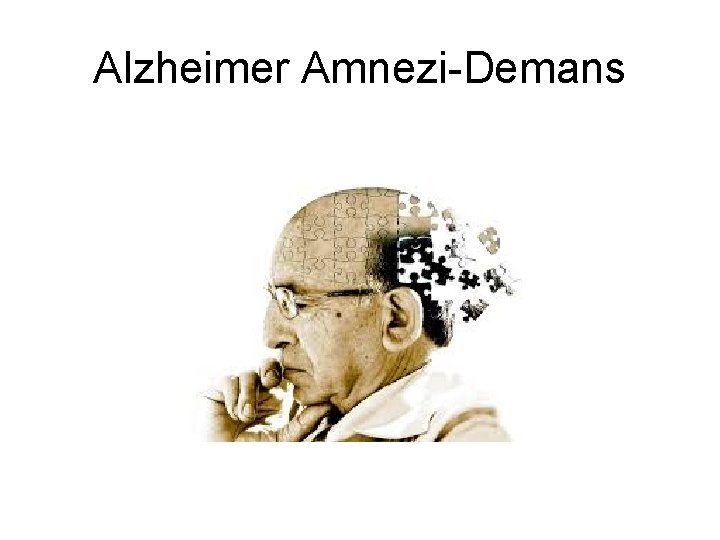 Alzheimer Amnezi-Demans Alzheimer Amnezi-Demans
