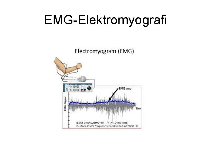 EMG-Elektromyografi EMG-Elektromyografi