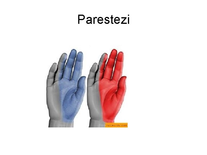 Parestezi Parestezi