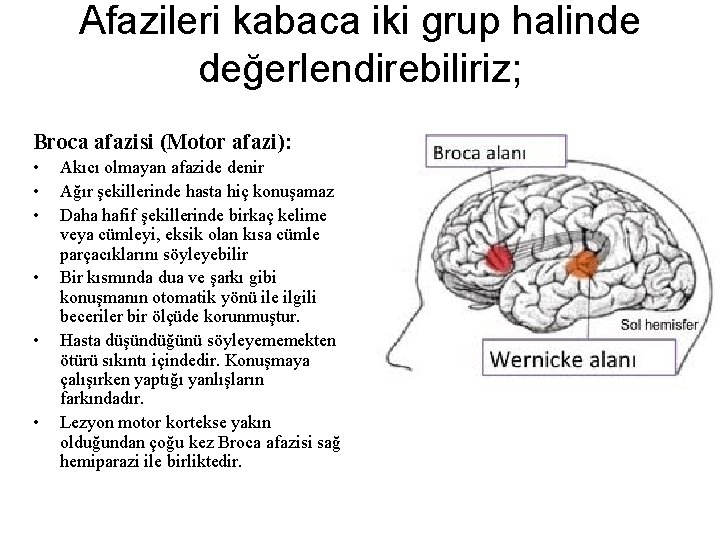 Afazileri kabaca iki grup halinde değerlendirebiliriz; Broca afazisi (Motor afazi): • • • Akıcı Afazileri kabaca iki grup halinde değerlendirebiliriz; Broca afazisi (Motor afazi): • • • Akıcı