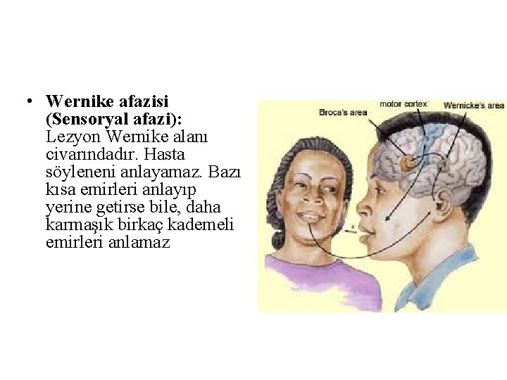 • Wernike afazisi (Sensoryal afazi): Lezyon Wernike alanı civarındadır. Hasta söyleneni anlayamaz. Bazı • Wernike afazisi (Sensoryal afazi): Lezyon Wernike alanı civarındadır. Hasta söyleneni anlayamaz. Bazı