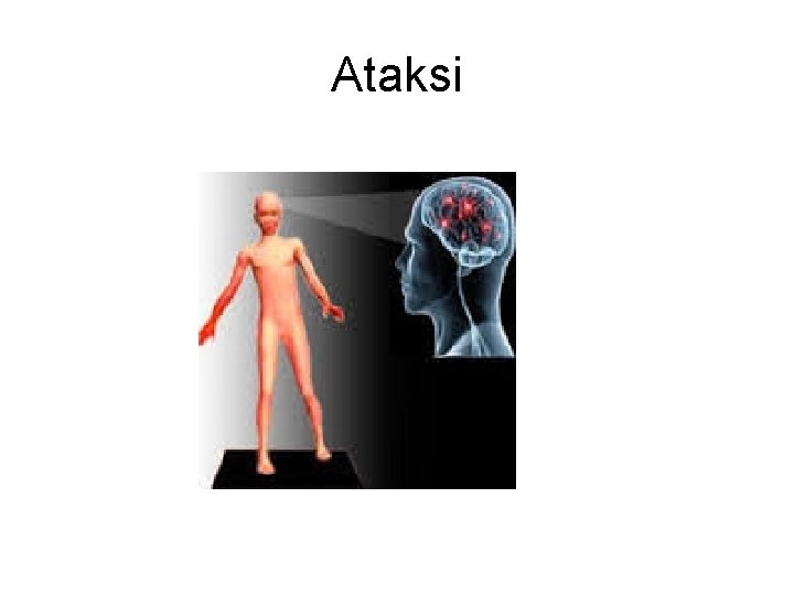 Ataksi Ataksi