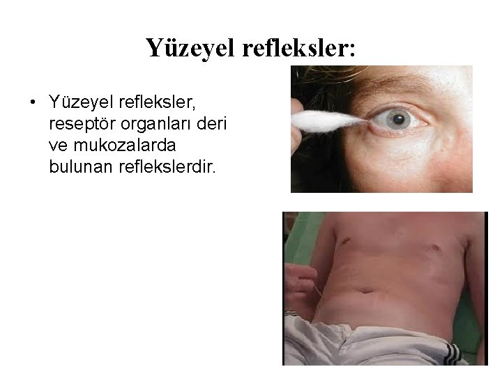 Yüzeyel refleksler: • Yüzeyel refleksler, reseptör organları deri ve mukozalarda bulunan reflekslerdir. Yüzeyel refleksler: • Yüzeyel refleksler, reseptör organları deri ve mukozalarda bulunan reflekslerdir.