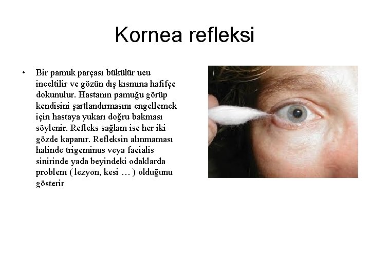 Kornea refleksi • Bir pamuk parçası bükülür ucu inceltilir ve gözün dış kısmına hafifçe Kornea refleksi • Bir pamuk parçası bükülür ucu inceltilir ve gözün dış kısmına hafifçe