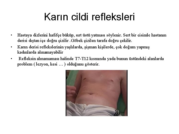 Karın cildi refleksleri • • • Hastaya dizlerini hafifçe büküp, sırt üstü yatması söylenir. Karın cildi refleksleri • • • Hastaya dizlerini hafifçe büküp, sırt üstü yatması söylenir.