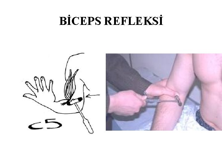 BİCEPS REFLEKSİ BİCEPS REFLEKSİ