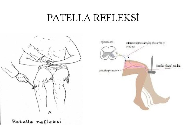PATELLA REFLEKSİ PATELLA REFLEKSİ
