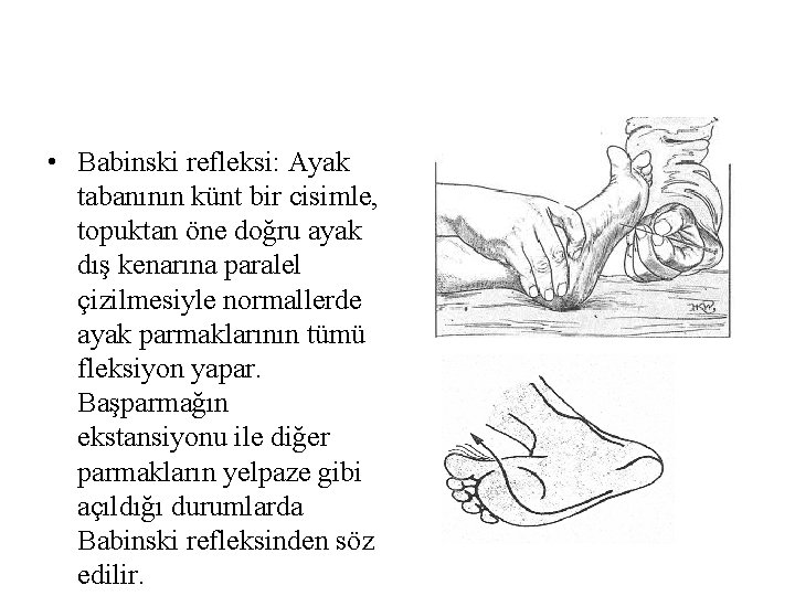 • Babinski refleksi: Ayak tabanının künt bir cisimle, topuktan öne doğru ayak dış • Babinski refleksi: Ayak tabanının künt bir cisimle, topuktan öne doğru ayak dış