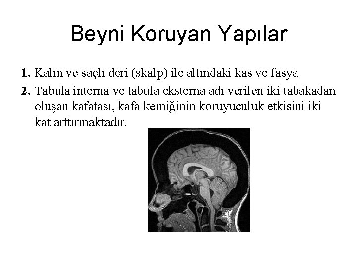 Beyni Koruyan Yapılar 1. Kalın ve saçlı deri (skalp) ile altındaki kas ve fasya Beyni Koruyan Yapılar 1. Kalın ve saçlı deri (skalp) ile altındaki kas ve fasya