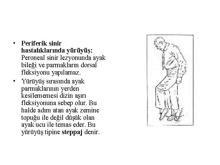 • Periferik sinir hastalıklarında yürüyüş: Peroneal sinir lezyonunda ayak bileği ve parmakların dorsal • Periferik sinir hastalıklarında yürüyüş: Peroneal sinir lezyonunda ayak bileği ve parmakların dorsal