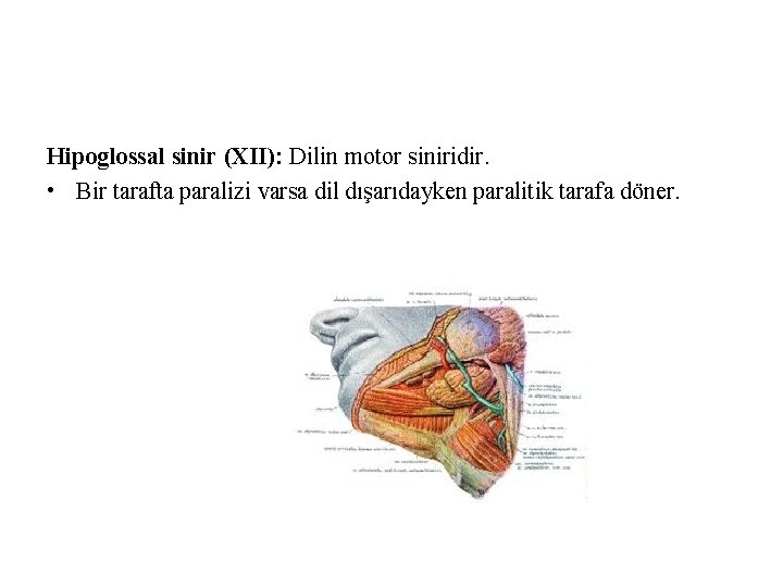Hipoglossal sinir (XII): Dilin motor siniridir. • Bir tarafta paralizi varsa dil dışarıdayken paralitik Hipoglossal sinir (XII): Dilin motor siniridir. • Bir tarafta paralizi varsa dil dışarıdayken paralitik
