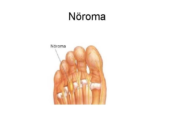 Nöroma Nöroma