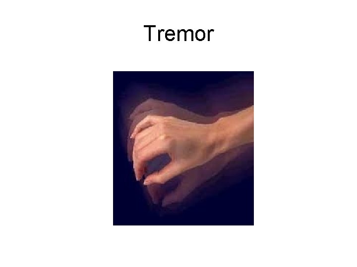 Tremor Tremor
