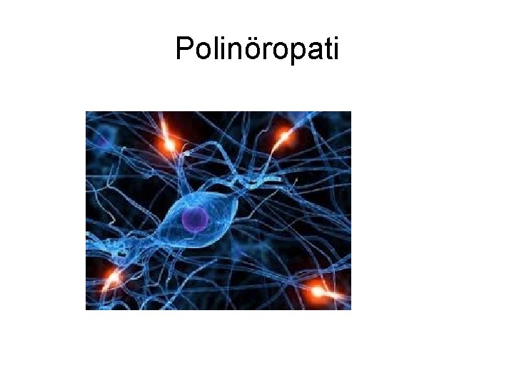Polinöropati Polinöropati