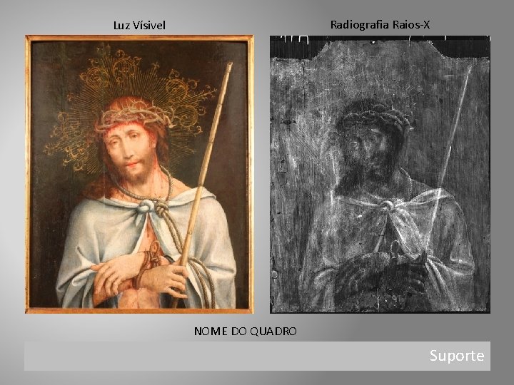 Radiografia Raios-X Luz Vísivel NOME DO QUADRO Suporte 