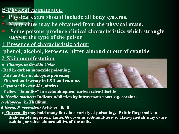 B-Physical examination • Physical exam should include all body systems. • Many clues may