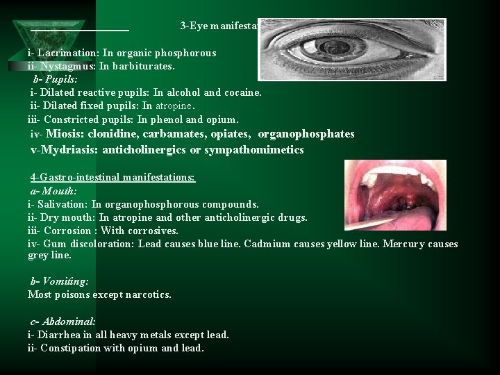  3 -Eye manifestation: i- Lacrimation: In organic phosphorous ii- Nystagmus: In barbiturates. b-