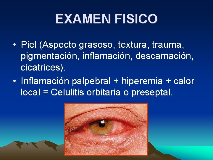 EXAMEN FISICO • Piel (Aspecto grasoso, textura, trauma, pigmentación, inflamación, descamación, cicatrices). • Inflamación EXAMEN FISICO • Piel (Aspecto grasoso, textura, trauma, pigmentación, inflamación, descamación, cicatrices). • Inflamación