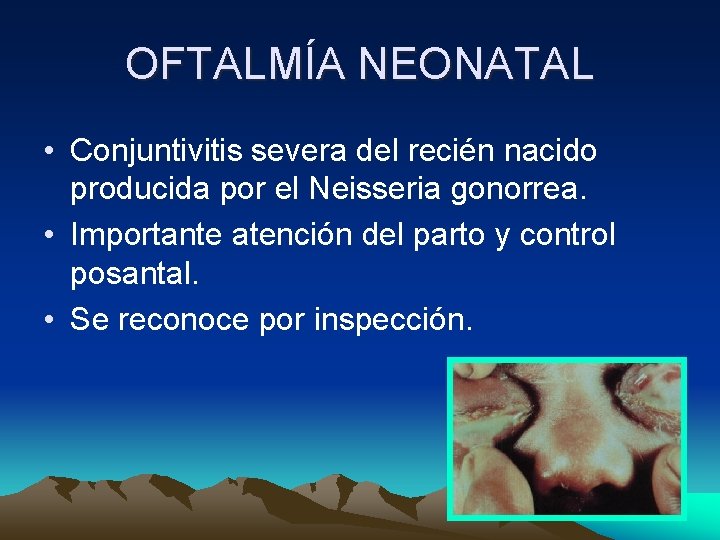 OFTALMÍA NEONATAL • Conjuntivitis severa del recién nacido producida por el Neisseria gonorrea. • OFTALMÍA NEONATAL • Conjuntivitis severa del recién nacido producida por el Neisseria gonorrea. •