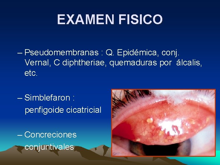 EXAMEN FISICO – Pseudomembranas : Q. Epidémica, conj. Vernal, C diphtheriae, quemaduras por álcalis, EXAMEN FISICO – Pseudomembranas : Q. Epidémica, conj. Vernal, C diphtheriae, quemaduras por álcalis,
