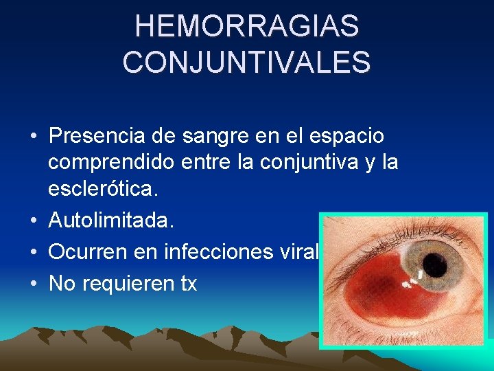 HEMORRAGIAS CONJUNTIVALES • Presencia de sangre en el espacio comprendido entre la conjuntiva y HEMORRAGIAS CONJUNTIVALES • Presencia de sangre en el espacio comprendido entre la conjuntiva y