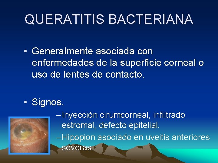 QUERATITIS BACTERIANA • Generalmente asociada con enfermedades de la superficie corneal o uso de QUERATITIS BACTERIANA • Generalmente asociada con enfermedades de la superficie corneal o uso de