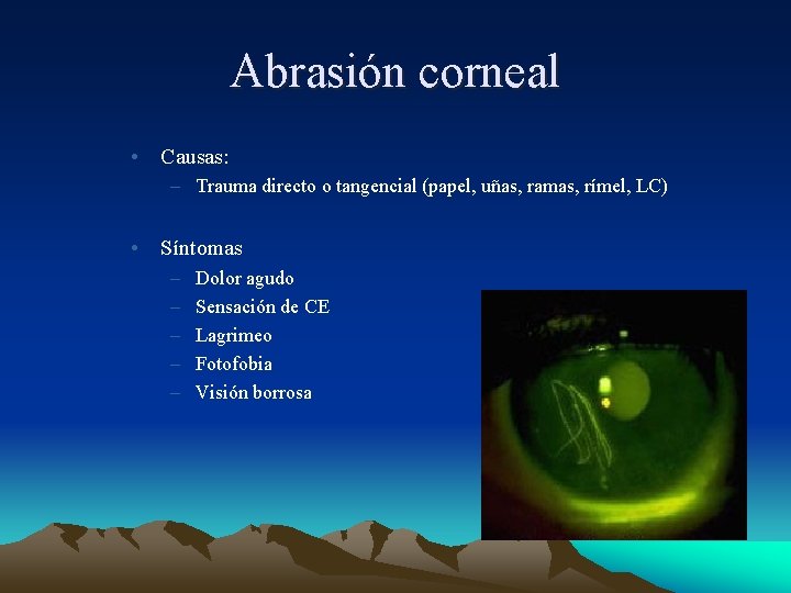 Abrasión corneal • Causas: – Trauma directo o tangencial (papel, uñas, ramas, rímel, LC) Abrasión corneal • Causas: – Trauma directo o tangencial (papel, uñas, ramas, rímel, LC)