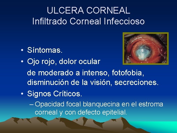 ULCERA CORNEAL Infiltrado Corneal Infeccioso • Síntomas. • Ojo rojo, dolor ocular de moderado ULCERA CORNEAL Infiltrado Corneal Infeccioso • Síntomas. • Ojo rojo, dolor ocular de moderado