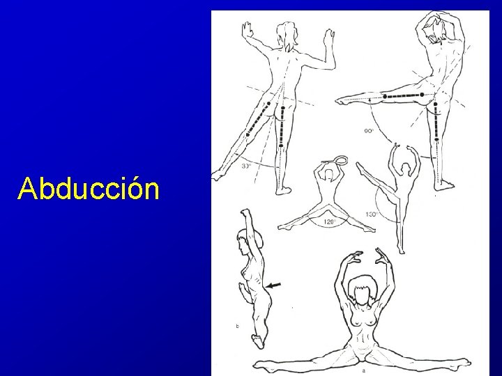 Abducción Abducción