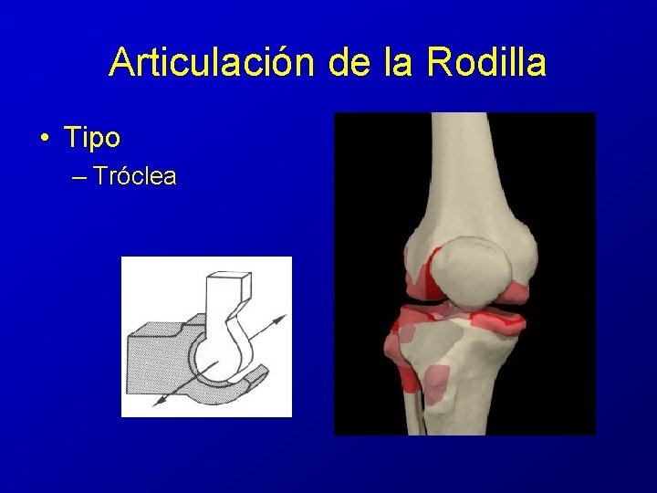 Articulación de la Rodilla • Tipo – Tróclea 