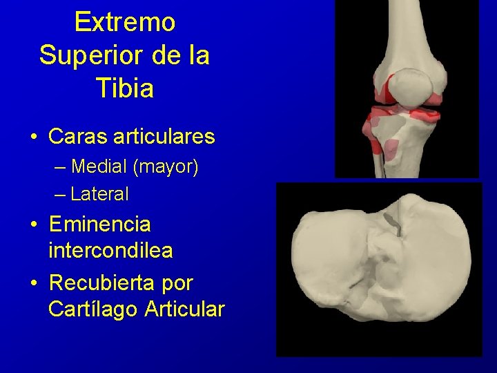 Extremo Superior de la Tibia • Caras articulares – Medial (mayor) – Lateral • Extremo Superior de la Tibia • Caras articulares – Medial (mayor) – Lateral •
