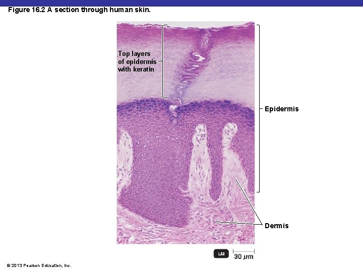 Figure 16. 2 A section through human skin. Top layers of epidermis with keratin
