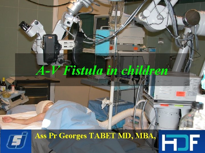 A-V Fistula in children Ass Pr Georges TABET MD, MBA, 