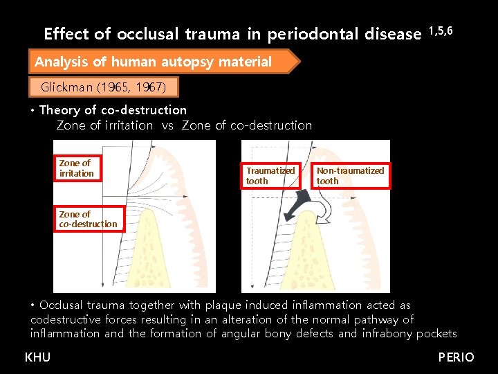 Effect of occlusal trauma in periodontal disease 1, 5, 6 Analysis of human autopsy