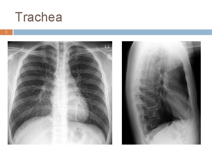 Trachea 3 