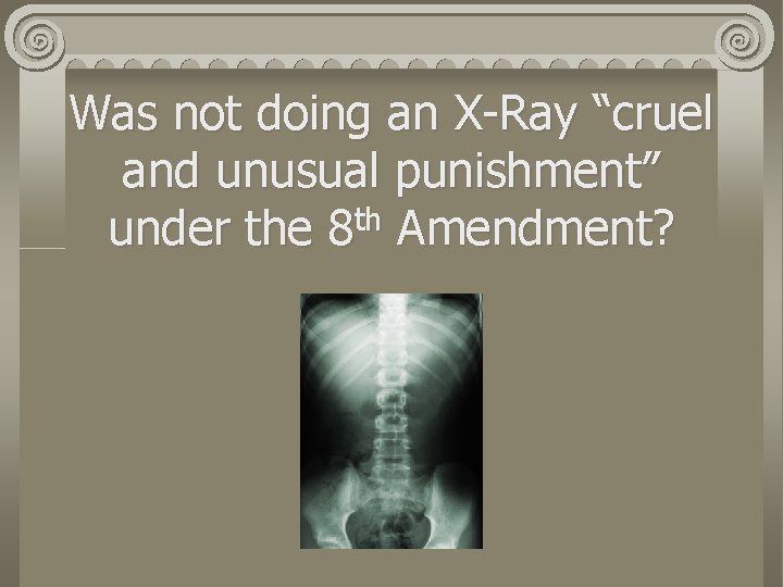Was not doing an X-Ray “cruel and unusual punishment” th under the 8 Amendment?