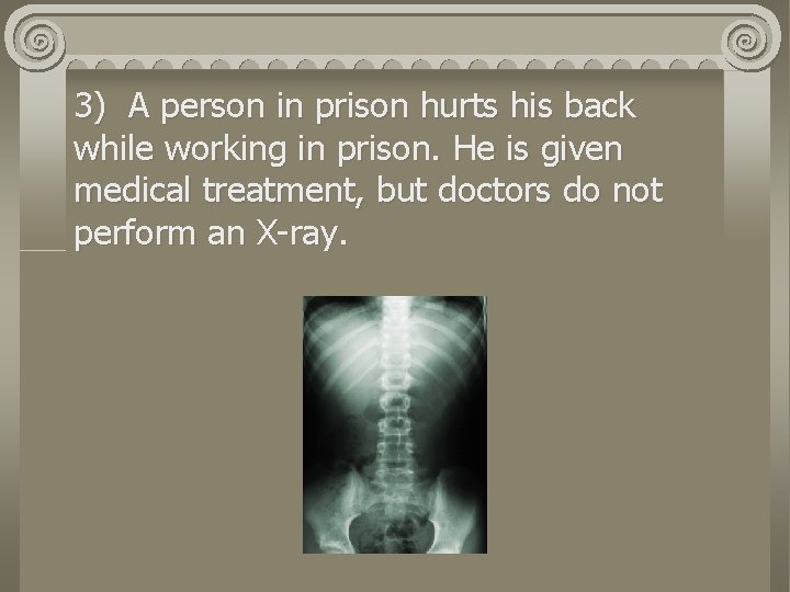 3) A person in prison hurts his back while working in prison. He is