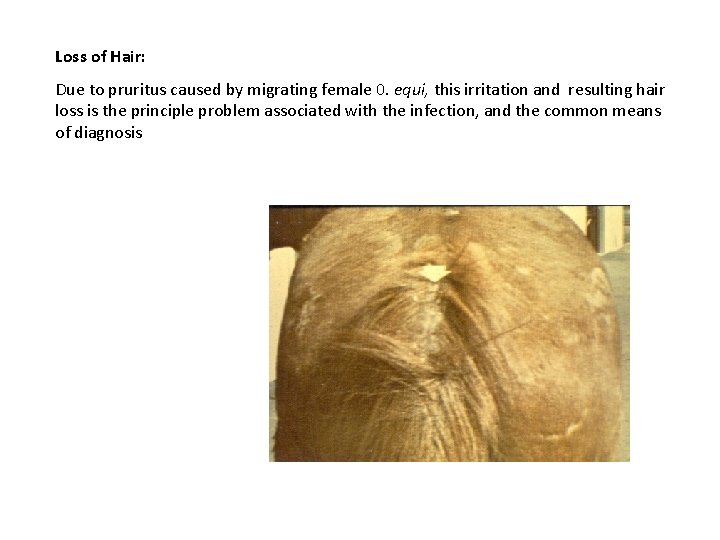 Loss of Hair: Due to pruritus caused by migrating female 0. equi, this irritation