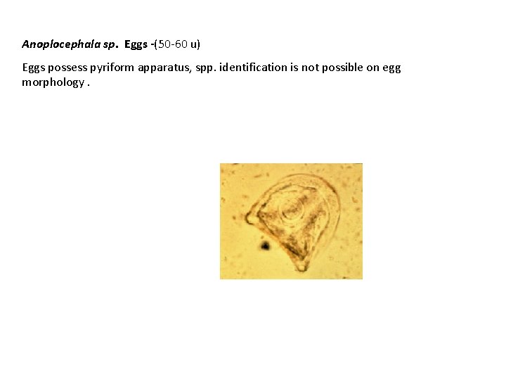 Anoplocephala sp. Eggs -(50 -60 u) Eggs possess pyriform apparatus, spp. identification is not