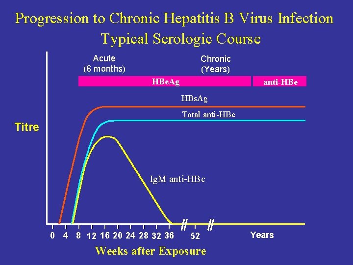 Progression to Chronic Hepatitis B Virus Infection Typical Serologic Course Acute (6 months) Chronic