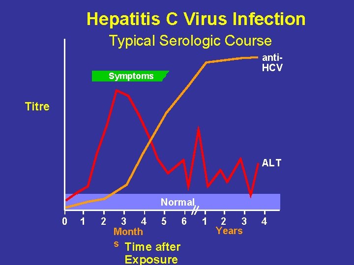 Hepatitis C Virus Infection Typical Serologic Course anti. HCV Symptoms Titre ALT Normal 0