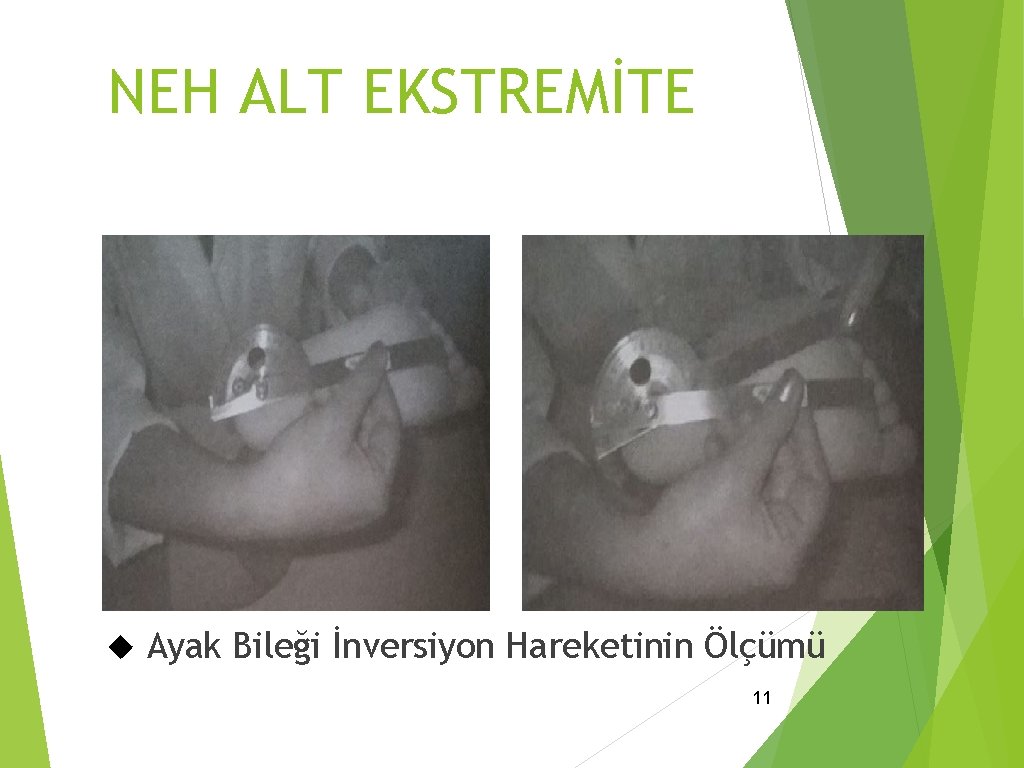 NEH ALT EKSTREMİTE Ayak Bileği İnversiyon Hareketinin Ölçümü 11 