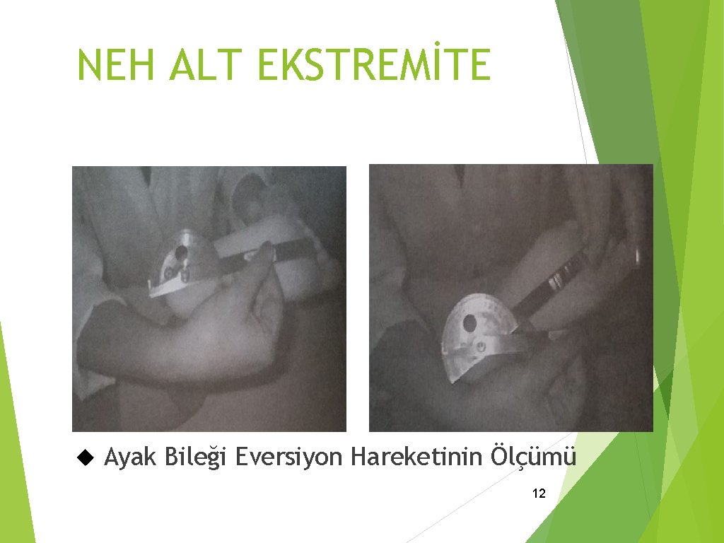 NEH ALT EKSTREMİTE Ayak Bileği Eversiyon Hareketinin Ölçümü 12 