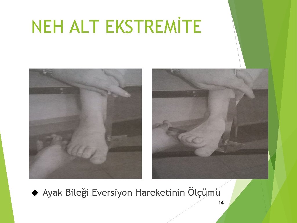 NEH ALT EKSTREMİTE Ayak Bileği Eversiyon Hareketinin Ölçümü 14 