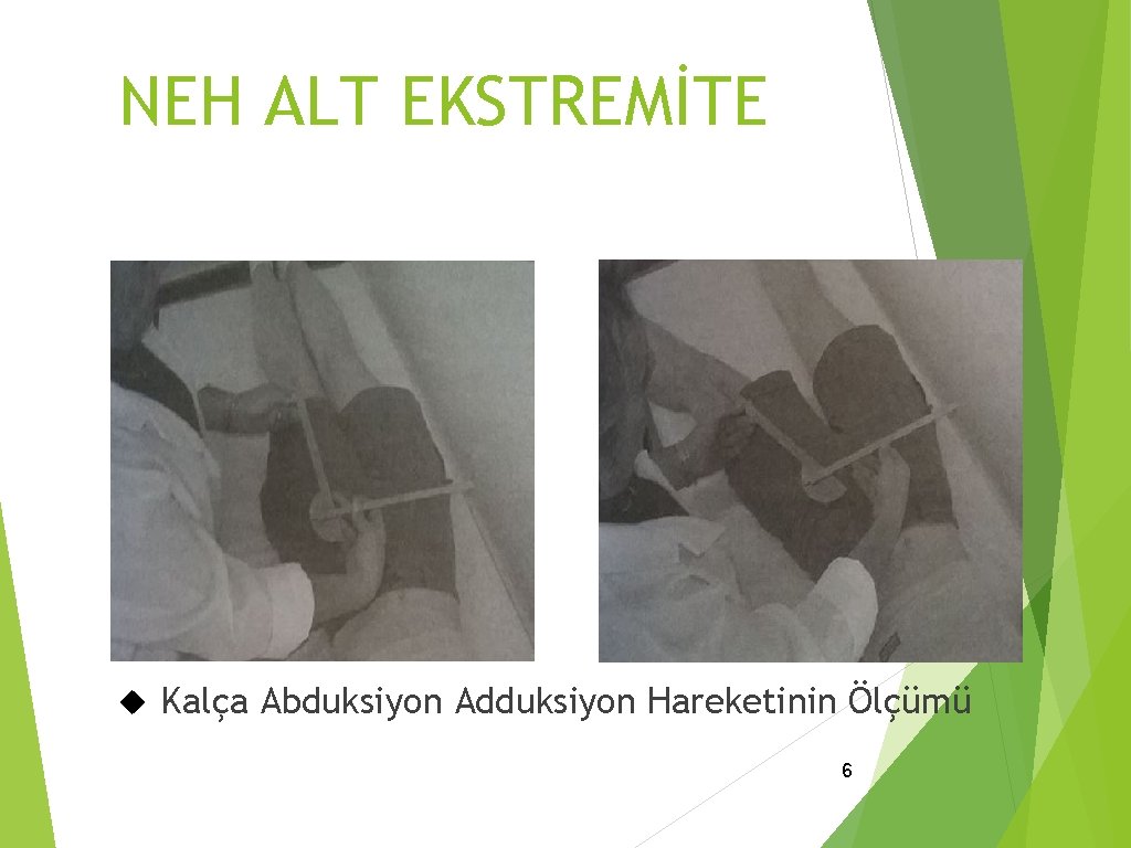 NEH ALT EKSTREMİTE Kalça Abduksiyon Adduksiyon Hareketinin Ölçümü 6 