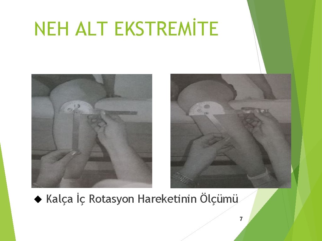 NEH ALT EKSTREMİTE Kalça İç Rotasyon Hareketinin Ölçümü 7 