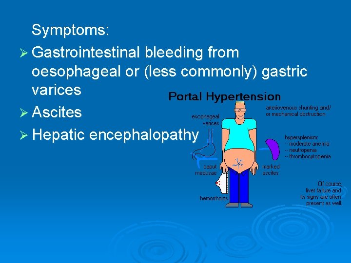 Symptoms: Ø Gastrointestinal bleeding from oesophageal or (less commonly) gastric varices Ø Ascites Ø