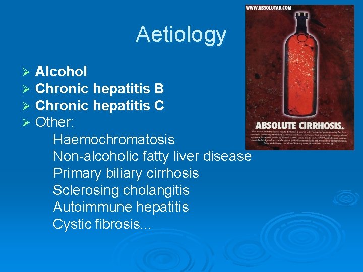 Aetiology Ø Ø Alcohol Chronic hepatitis B Chronic hepatitis C Other: Haemochromatosis Non-alcoholic fatty