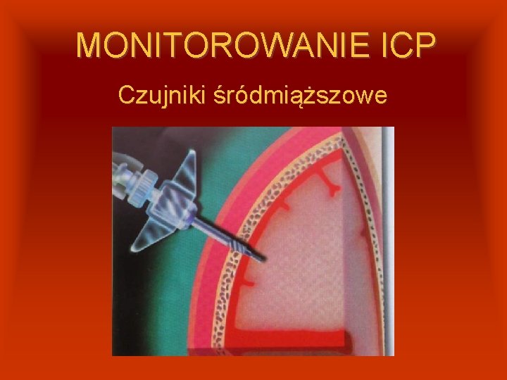 MONITOROWANIE ICP Czujniki śródmiąższowe 