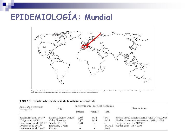 EPIDEMIOLOGÍA: Mundial EPIDEMIOLOGÍA: Mundial